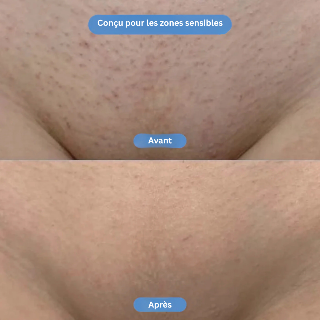 Purelle™ | BBL serum